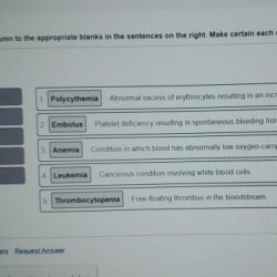 Trachea sectional cartilage trachealis anatomy smooth membranaceus paries membranous